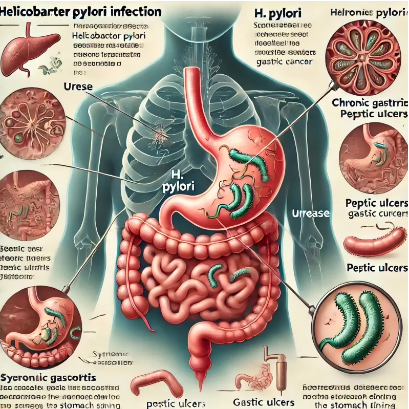 Testarea H. pylori a fost simplă: soluția dvs. pentru diagnostic rapid și fiabil